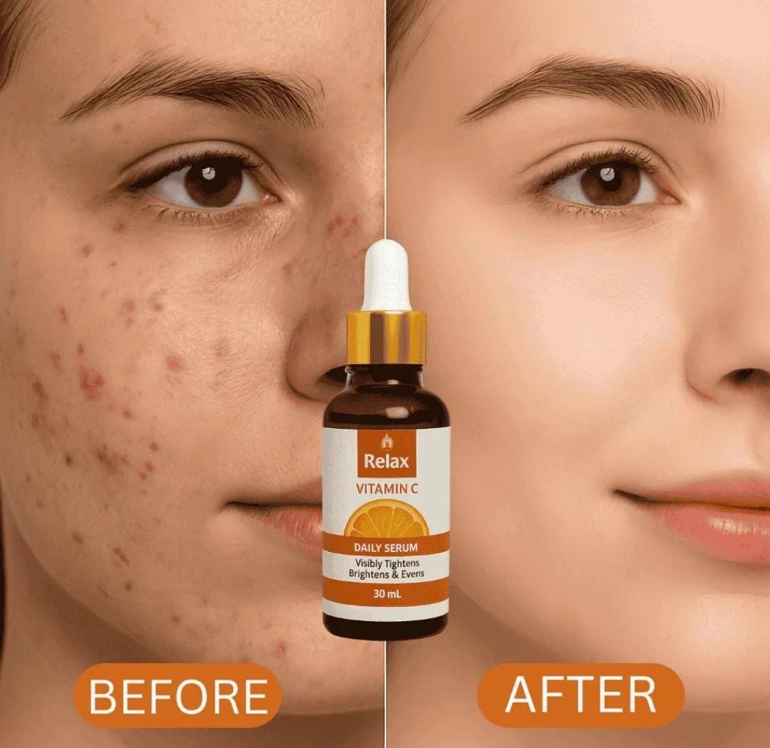 Relax Vitamin C Daily Serum - 30ml | Visibly Brightens, Evens Skin Tone, and Reduces Aging Signs for a Radiant, Youthful Glow View Gallery - Pakistan