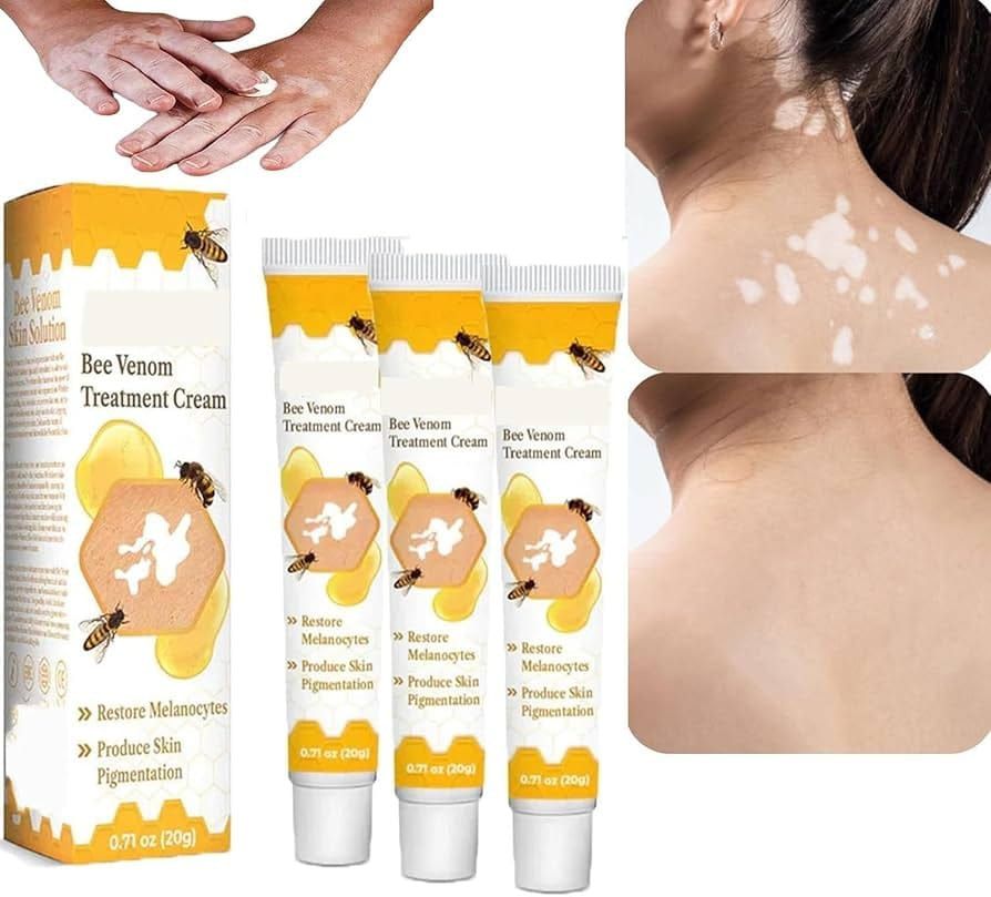 Fivfivgo™ VitiGO Bee Venom Correcting Cream (20g) – Advanced Melanocyte Support for Skin Pigmentation Recovery and Even Skin Tone View Gallery - Pakistan