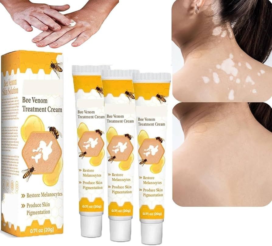 Bee Venom Vitiligo Treatment Cream - Restore Melanocytes & Skin Pigmentation - Natural Melanin Care Ointment for Leukoplakia (20g) View Gallery - Pakistan