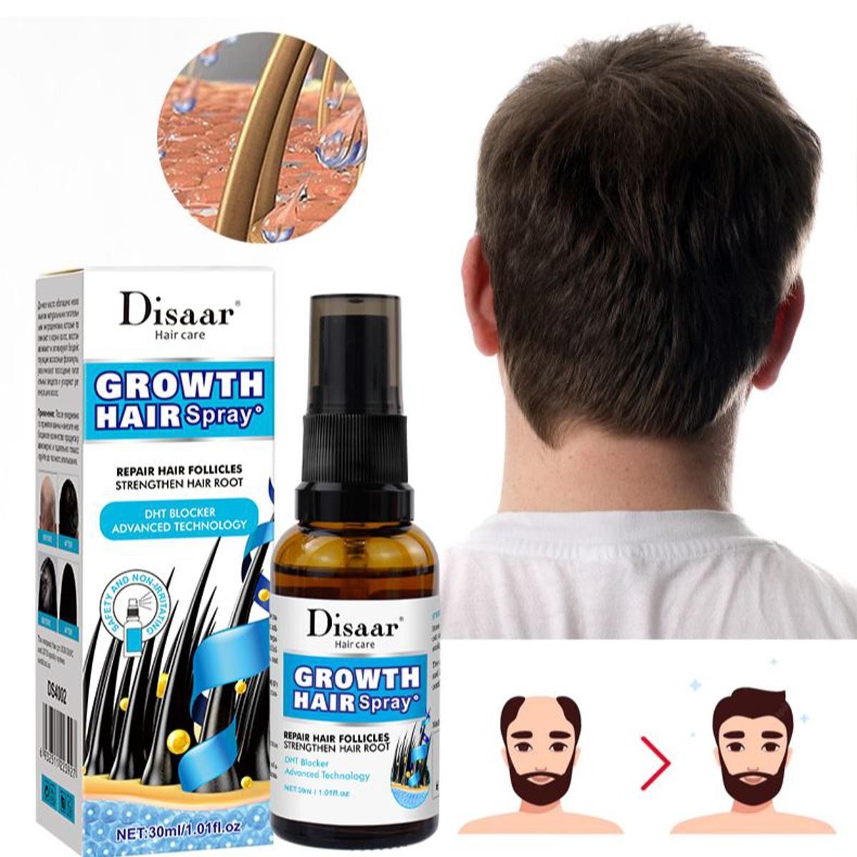 Disaar Vegan Ginseng Root Hair Growth Spray (30ml, DS4002): Natural Strengthener & Anti-Hair Loss Treatment View Gallery - Pakistan