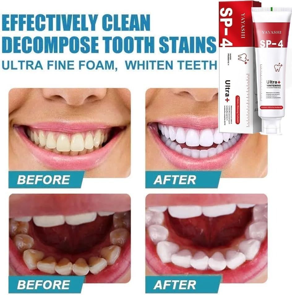 Yayashi SP-4 Ultra Whitening Toothpaste – 150ml Probiotic Stain Remover for Bright, Healthy Teeth View Gallery - Pakistan