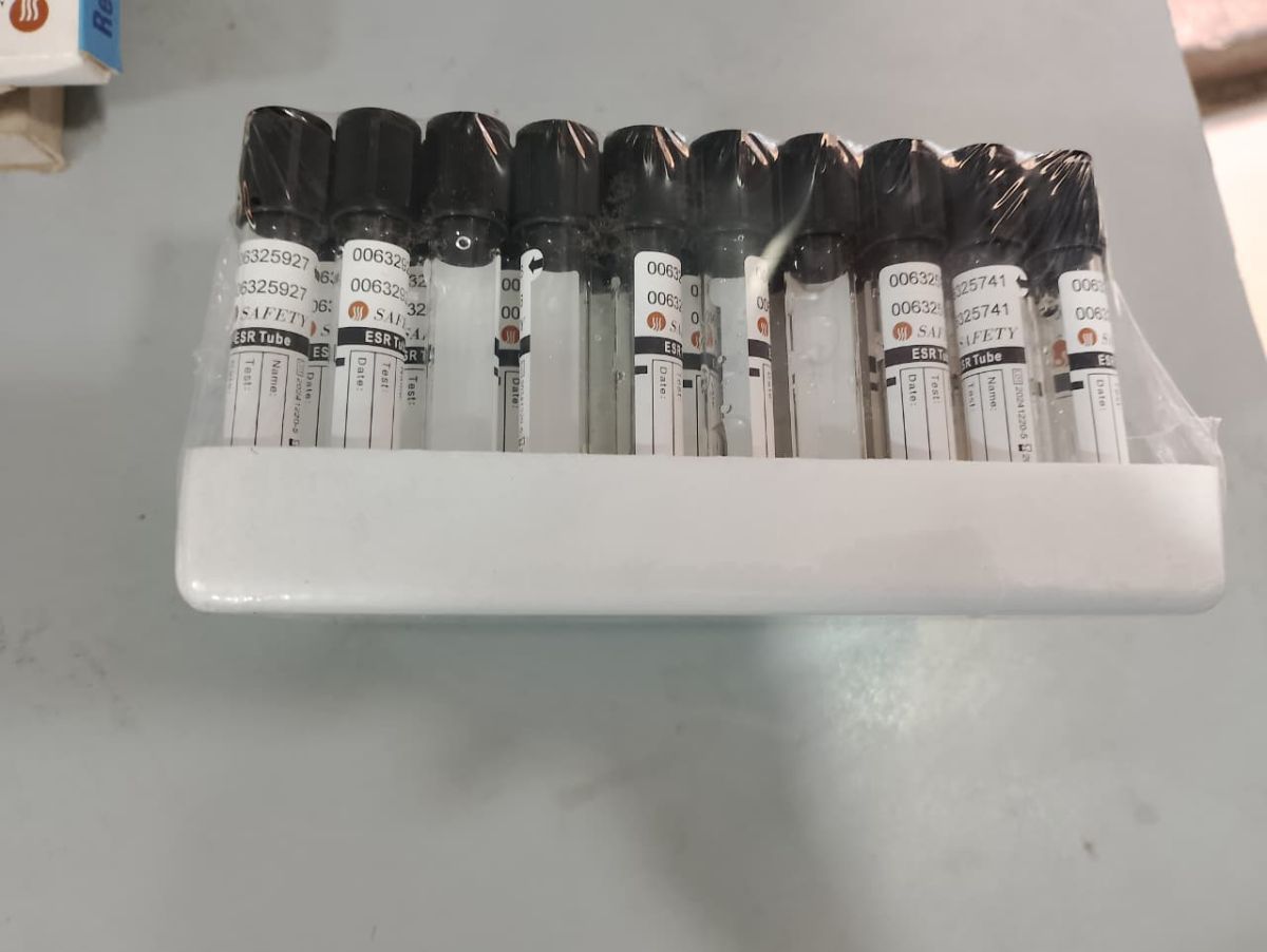 Safety Black Collection Tube – ESR Blood Test Tube 3ML, Secure Sample Collection, 100pcs Laboratory Pack View Gallery - Pakistan
