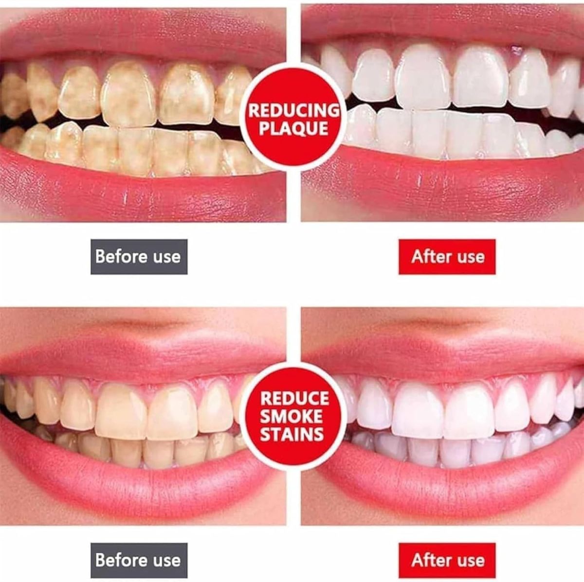 Yayashi Sp 4 Ultra Whitening Toothpaste Strong Stain Removal Fresh Breath Daily Oral Care - 120g View Gallery - Pakistan
