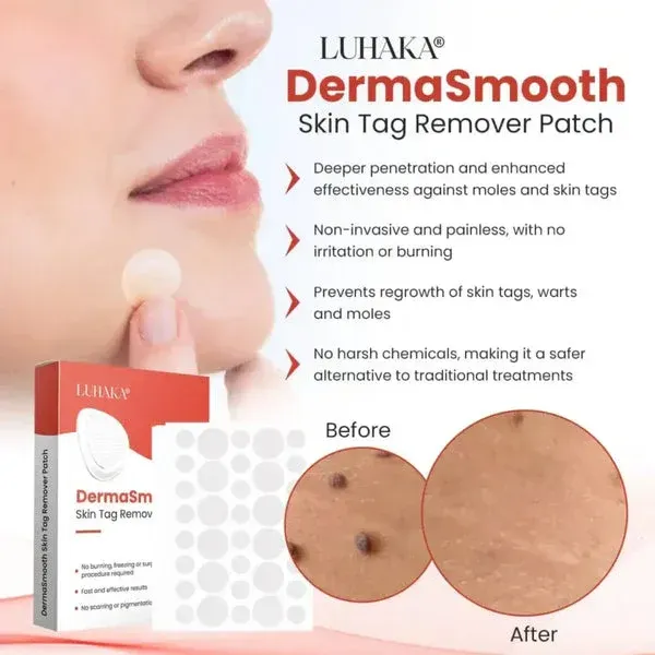 DermaSmooth Skin Tag Remover Patch – Fast, Safe, And Painless Skin Tag And Mole Removal Solution With No Scarring Or Pigmentation View Gallery - Pakistan