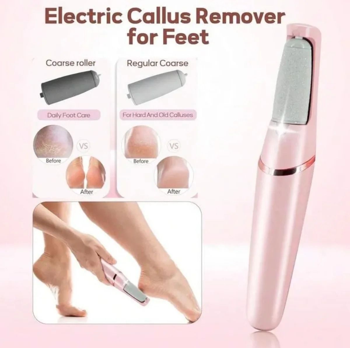 Rechargeable Callus Remover – Portable Foot Care Device for Smooth and Soft Skin View Gallery - Pakistan