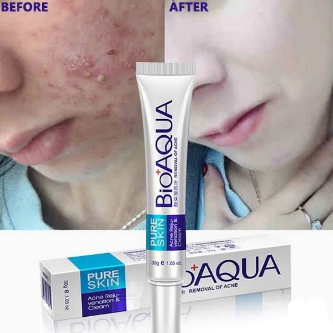 BIOAQUA Anti Acne Cream Acne Scar Removal Cream | Best Quality View Gallery - Pakistan