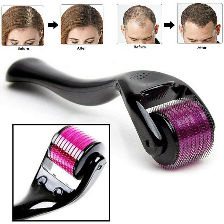Derma Roller 0.5mm Micro Needle for Skin Care, Hair Growth, Acne Scars & Anti-Aging View Gallery - Pakistan