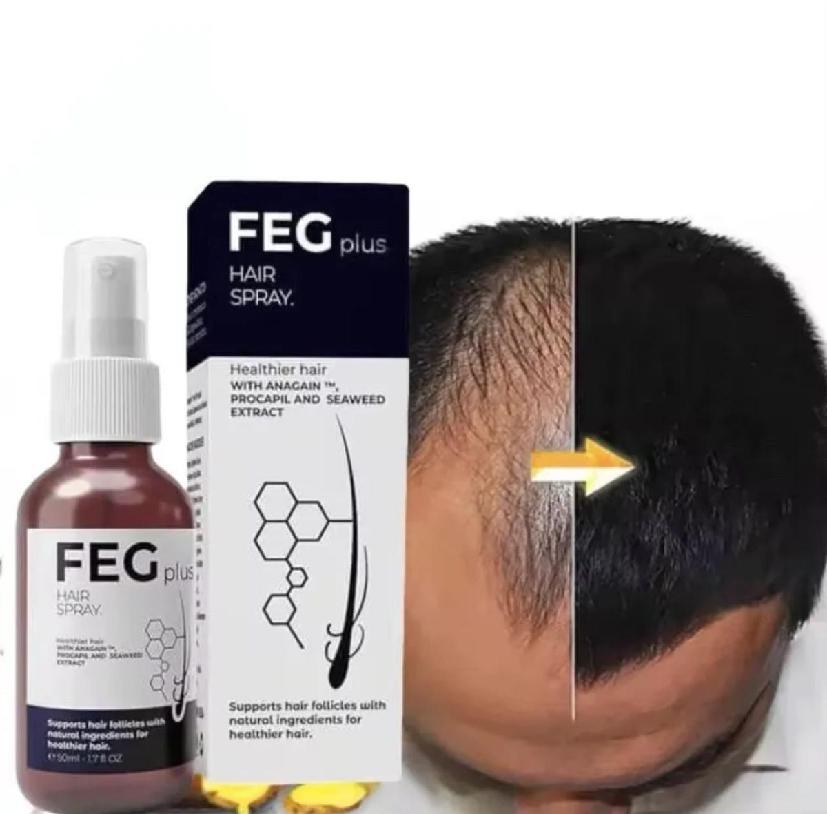 FEG PLUS Hair & Beard Regrowth Spray – Anti Hair Loss Formula with Minoxidil, Redensyl & Natural Extracts (50ml) View Gallery - Pakistan