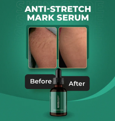Markaway Stretch Mark Serum – Herbal Formula For Hydration, Toning & Dark Spot Correction (30ml) View Gallery - Pakistan