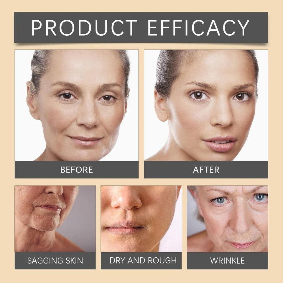 Botox Bee Venom Whitening & Moisturizing Cream – Anti-Aging, Brightening & Skin Firming Facial Care (100g) View Gallery - Pakistan