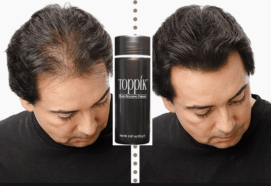Toppik Hair Building Fiber 27.5g | Instant Hair Thickening Solution For Thinning Hair | Natural Keratin Fibers For Fuller, Stronger, And Voluminous Look
