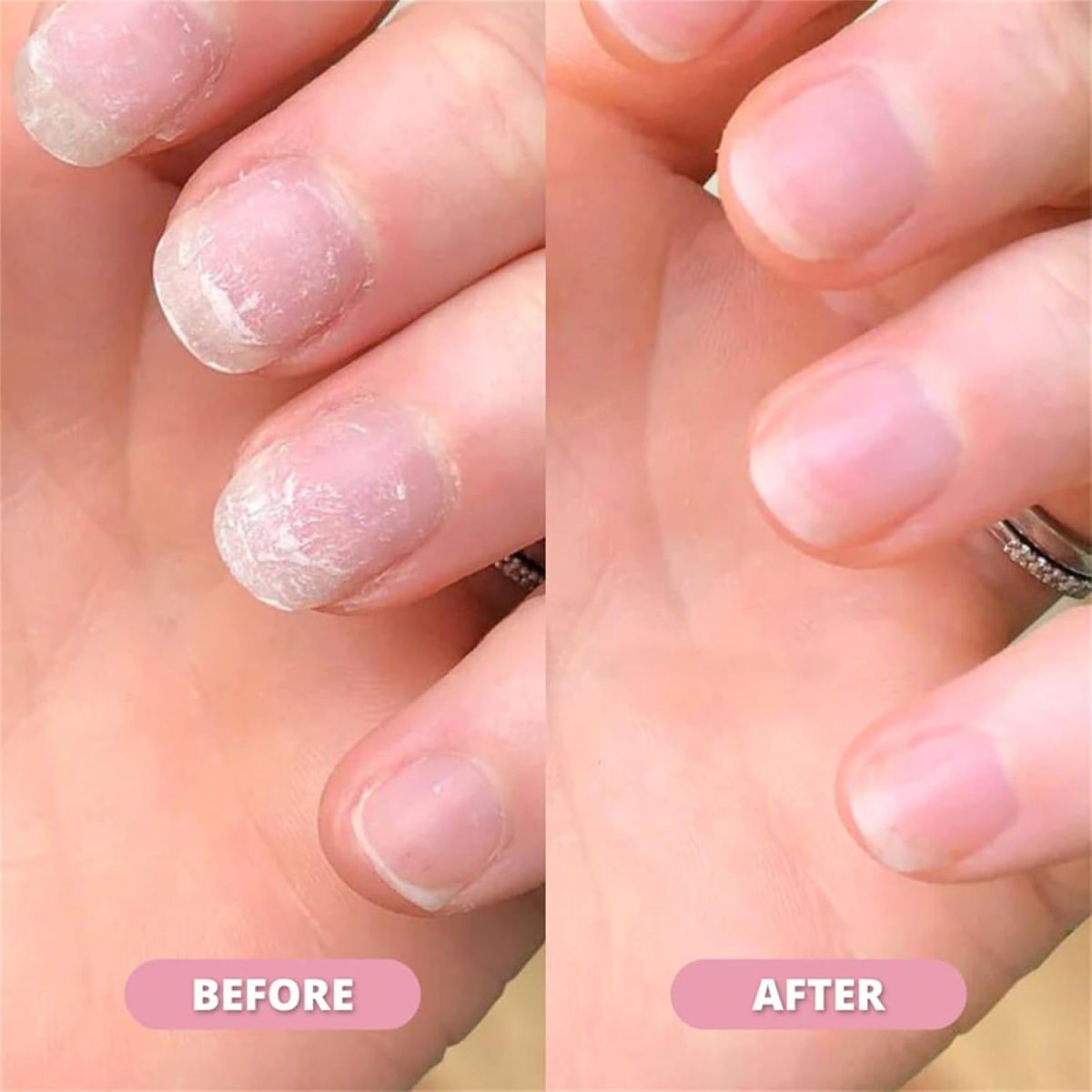 Nail Growth & Cuticle Oil Pen – Radiant Serum Nutrient Pen for Moisturizing, Strengthening & Brightening Nails View Gallery - Pakistan