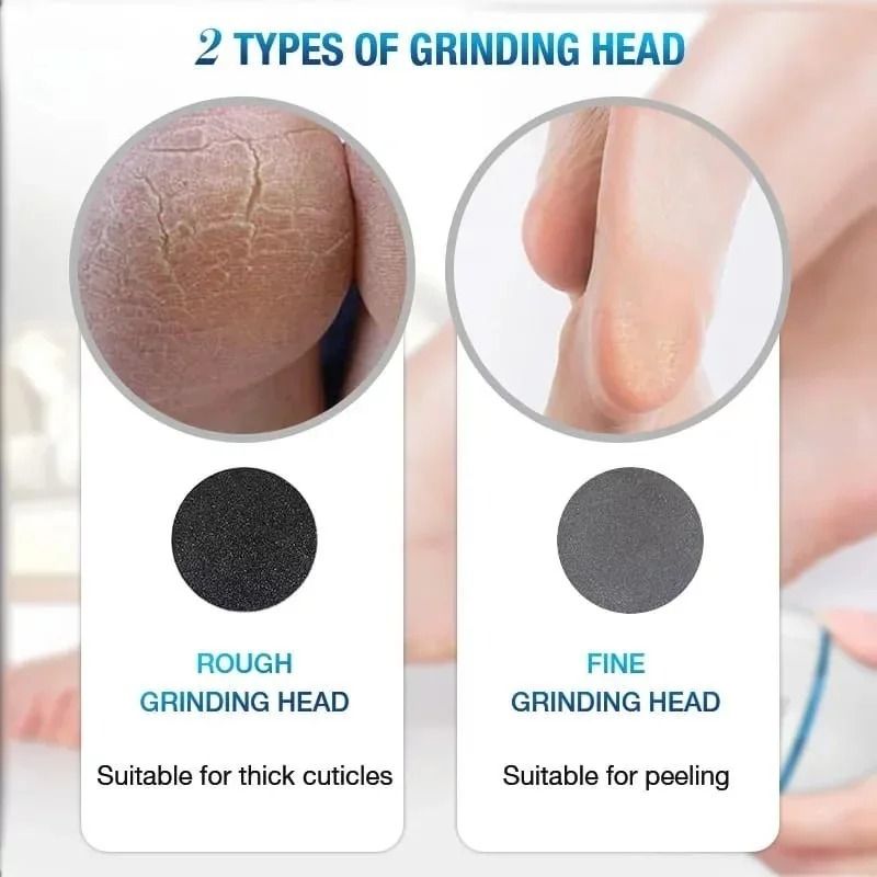 Back Callus Remover with Built-In Vacuum – Electric Foot Grinder for Dead Skin, Cracked Heels &amp; Calluses, Rechargeable Pedicure Tool with Gentle &amp; Powerful Exfoliation View Gallery - Pakistan