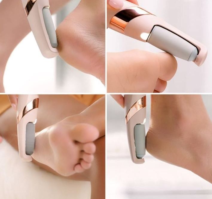 Rechargeable Electric Pedi Foot Filer – Effective Callus Remover for Soft, Smooth Feet View Gallery - Pakistan