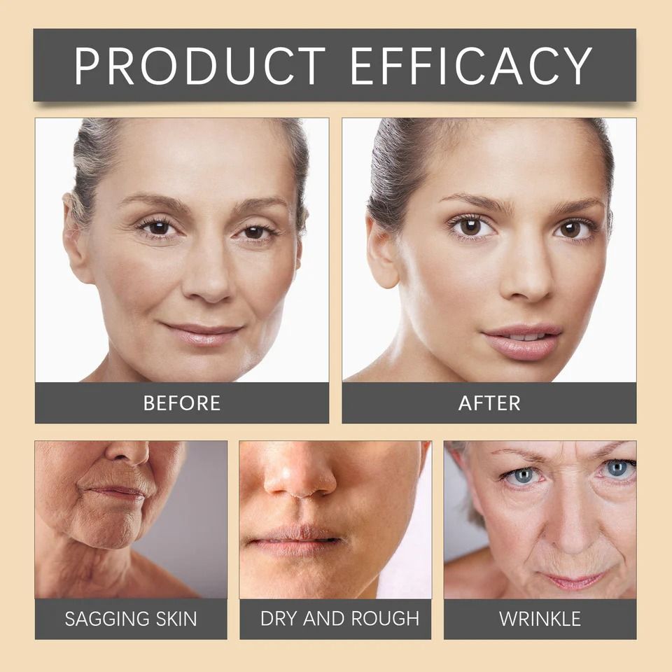 Bee Venom Botox Face Cream – Whitening, Anti-Aging & Deep Moisturizing Skincare for Bright, Smooth & Hydrated Skin View Gallery - Pakistan
