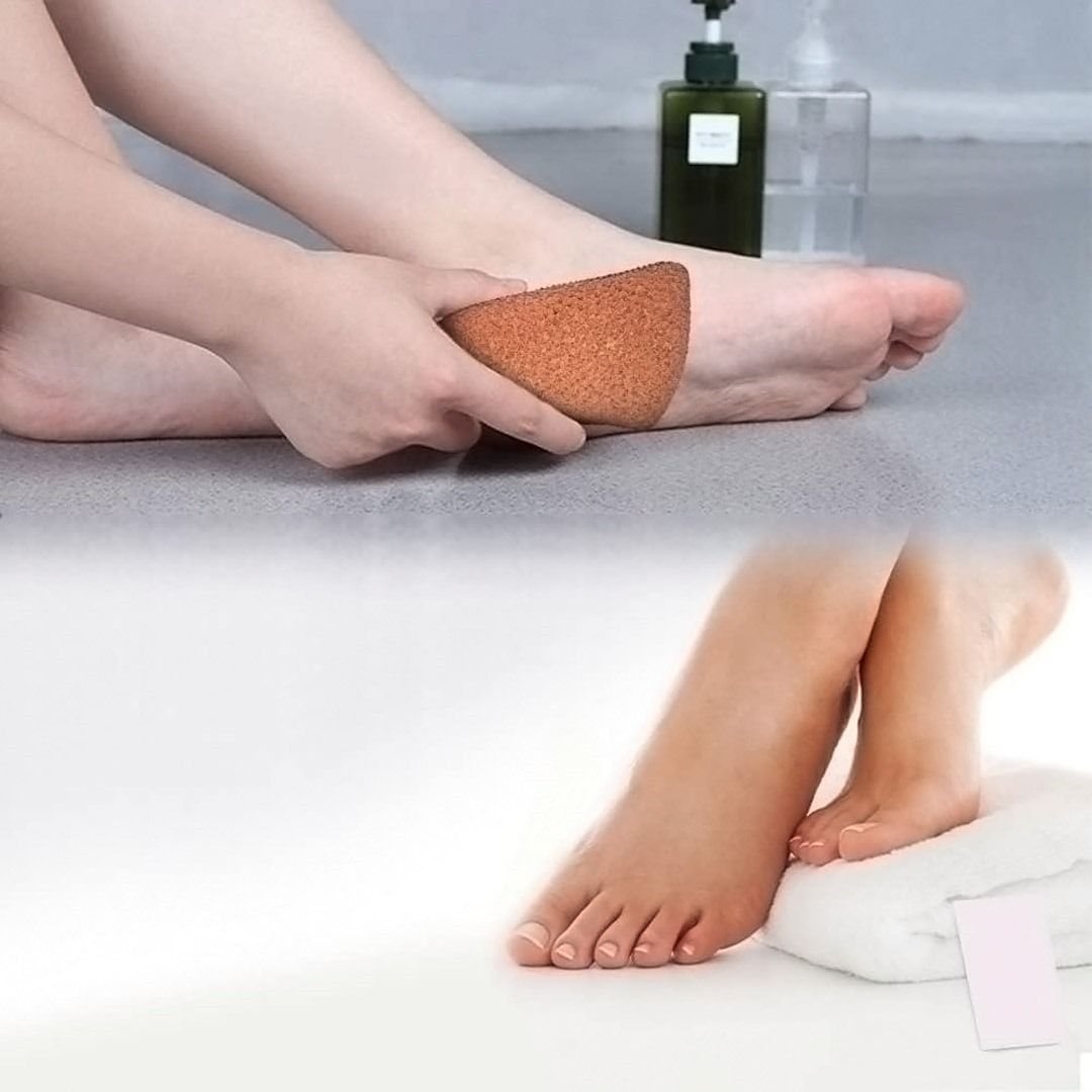 Mud Guru Foot Scrubber, Corn Remover for feet, Dead Skin Remover View Gallery - Pakistan
