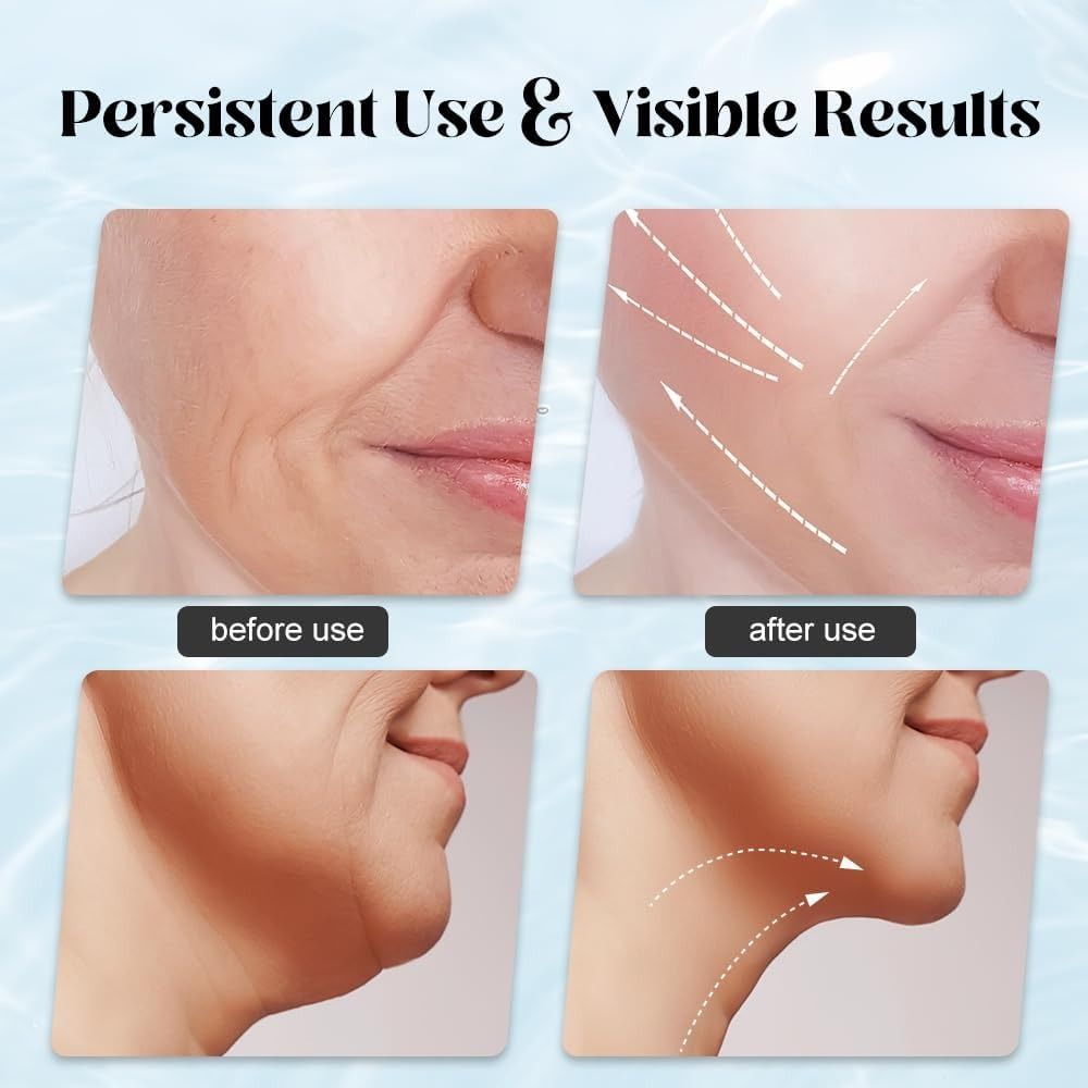 Massager for Face Lifting Facial Massagers EMS Neck Eye Massage Instrument Vibrator Microcurrents Red Light Therapy Anti Wrinkle - Random Color View Gallery - Pakistan