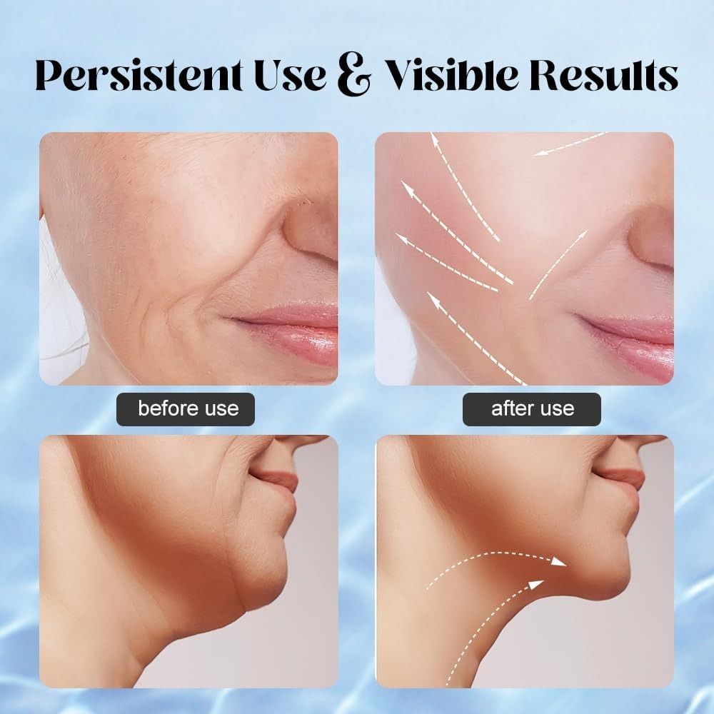Massager for Face Lifting Facial Massagers EMS Neck Eye Massage Instrument Vibrator Microcurrents Red Light Therapy Anti Wrinkle - Random Color View Gallery - Pakistan