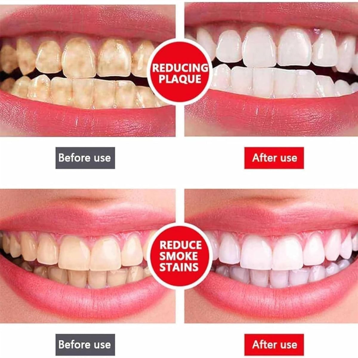 Yayashi Sp-4 Ultra Whitening Toothpaste Probiotic Stain Remover 100ml / Stain Removing Toothpaste, Protects Gums Freshens Breath, for Everyone View Gallery - Pakistan