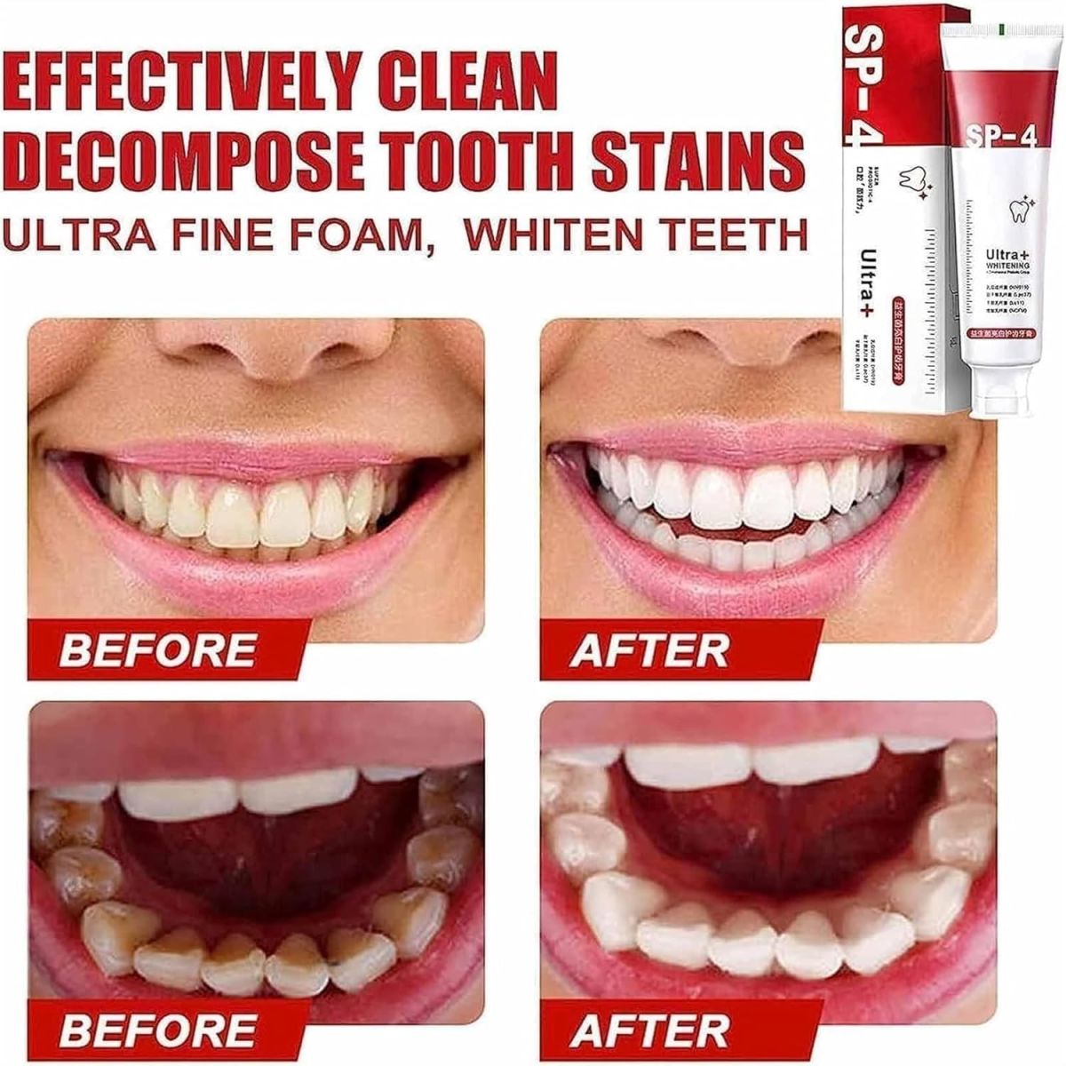 Yayashi Sp-4 Ultra Whitening Toothpaste Probiotic Stain Remover 100ml / Stain Removing Toothpaste, Protects Gums Freshens Breath, for Everyone View Gallery - Pakistan