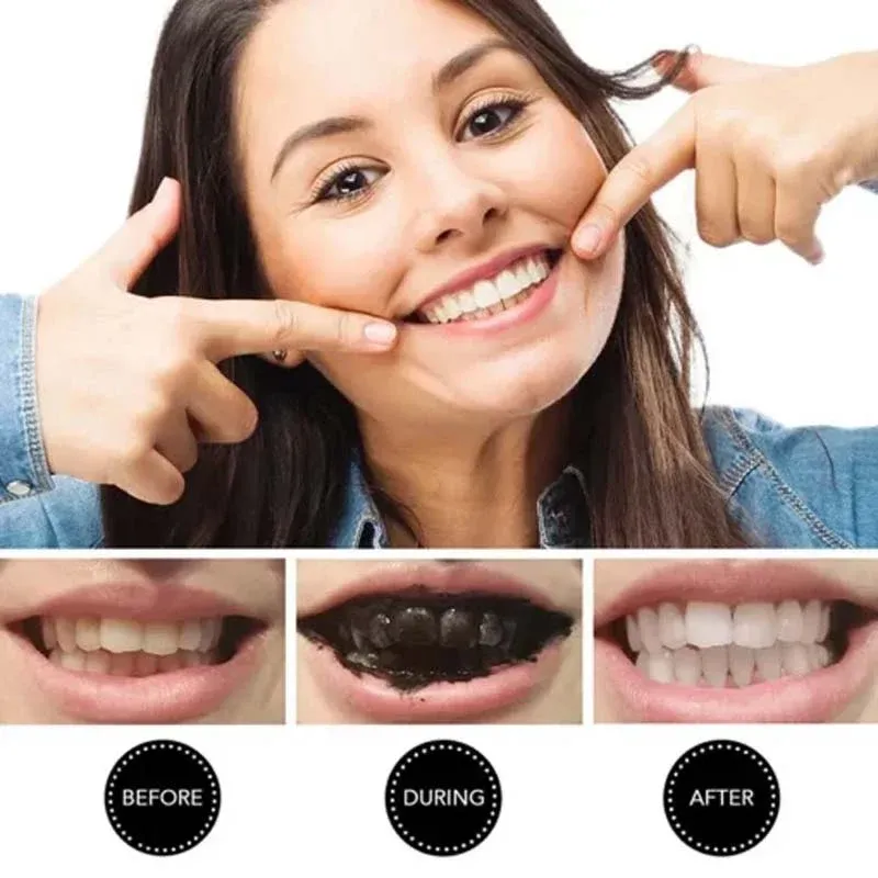 Teeth Whitening Charcoal Powder (Organic) Charcoal (30G) View Gallery - Pakistan