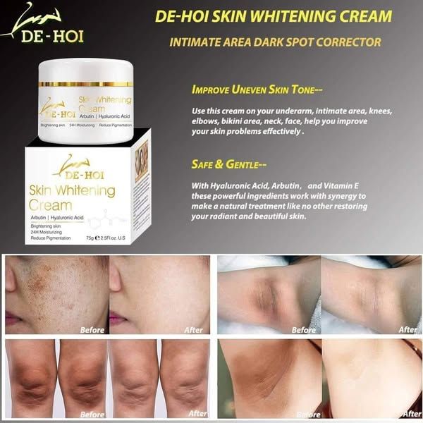 DE HOI Skin Whitening Cream – Brightening &amp; Moisturizing Face and Body Cream for Dark Skin - 75 gram View Gallery - Pakistan