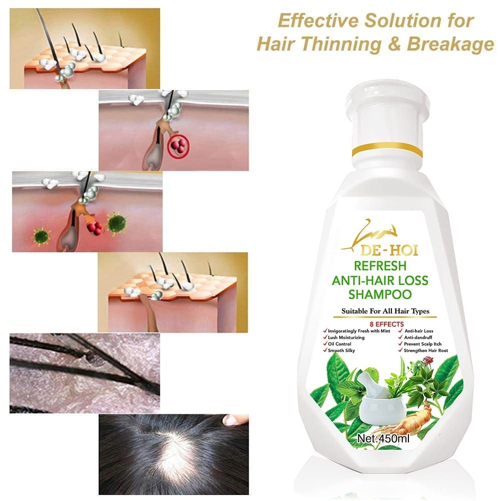 De-Hoi  Refresh Anti-hair Loss Shampoo Ginger Hair Care Shampoo Helps Stop Hair Loss 450ml View Gallery - Pakistan