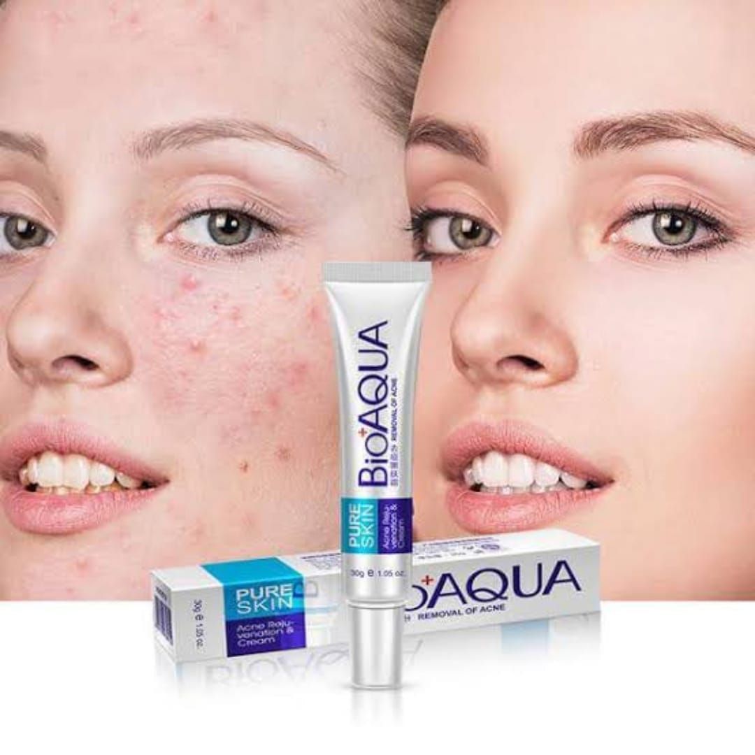 BIOAQUA Anti Acne Cream Acne Scar Removal Cream | Best Quality Scar Removal Cream 30g( Original ) View Gallery - Pakistan