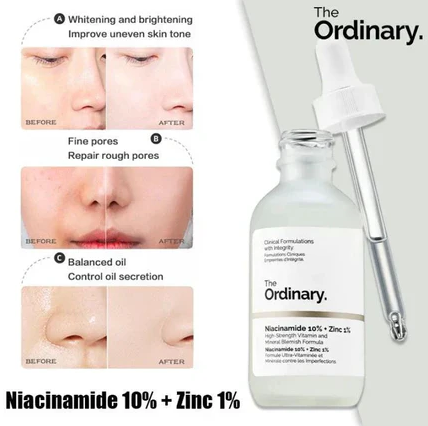 The Ordinary Niacinamide Serum 10% + Zinc 1% Supersize Serum 30ML | Best Quality Serum 30ML View Gallery - Pakistan