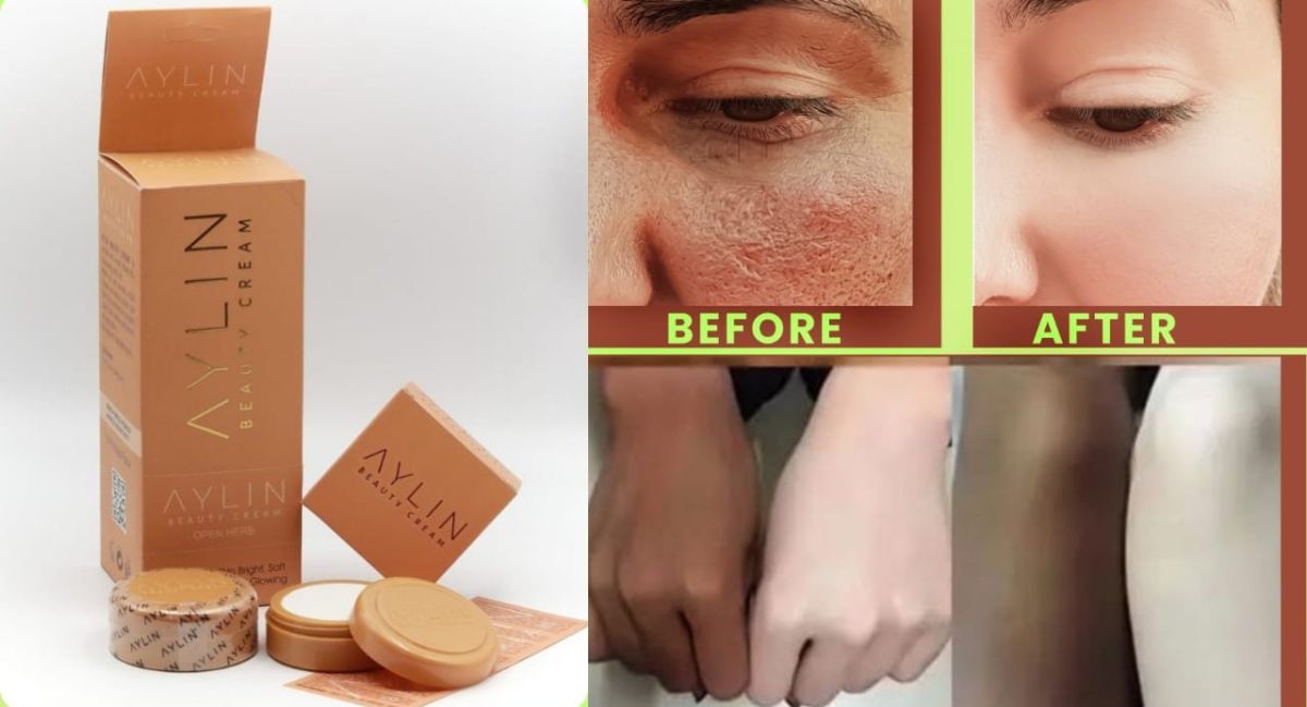 Aylin Beauty Cream Best Cream Ever | Best Quality Cream |  Aylin Beauty Cream For Face Acne Pimples, &amp; Blackheads | Whitening Cream ( Original ) View Gallery - Pakistan