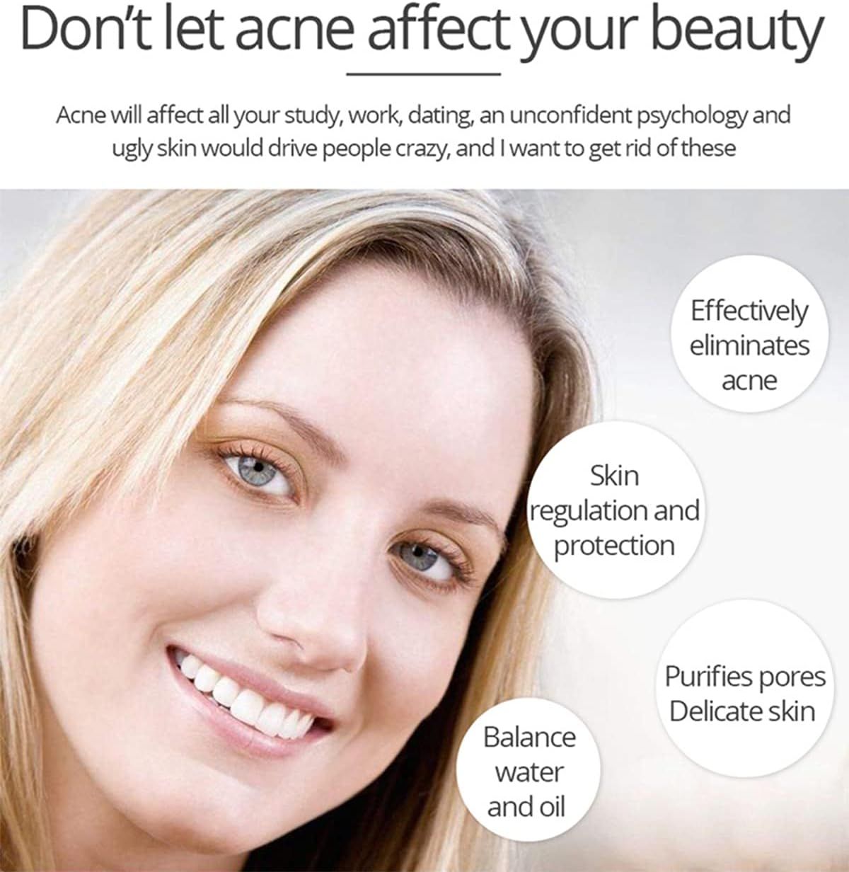 Aichun Beauty Anti - Acne Whitening Facial Serum Aloe Vera Extract Salicylic Acid Repairs Damaged Skin | 30ml View Gallery - Pakistan