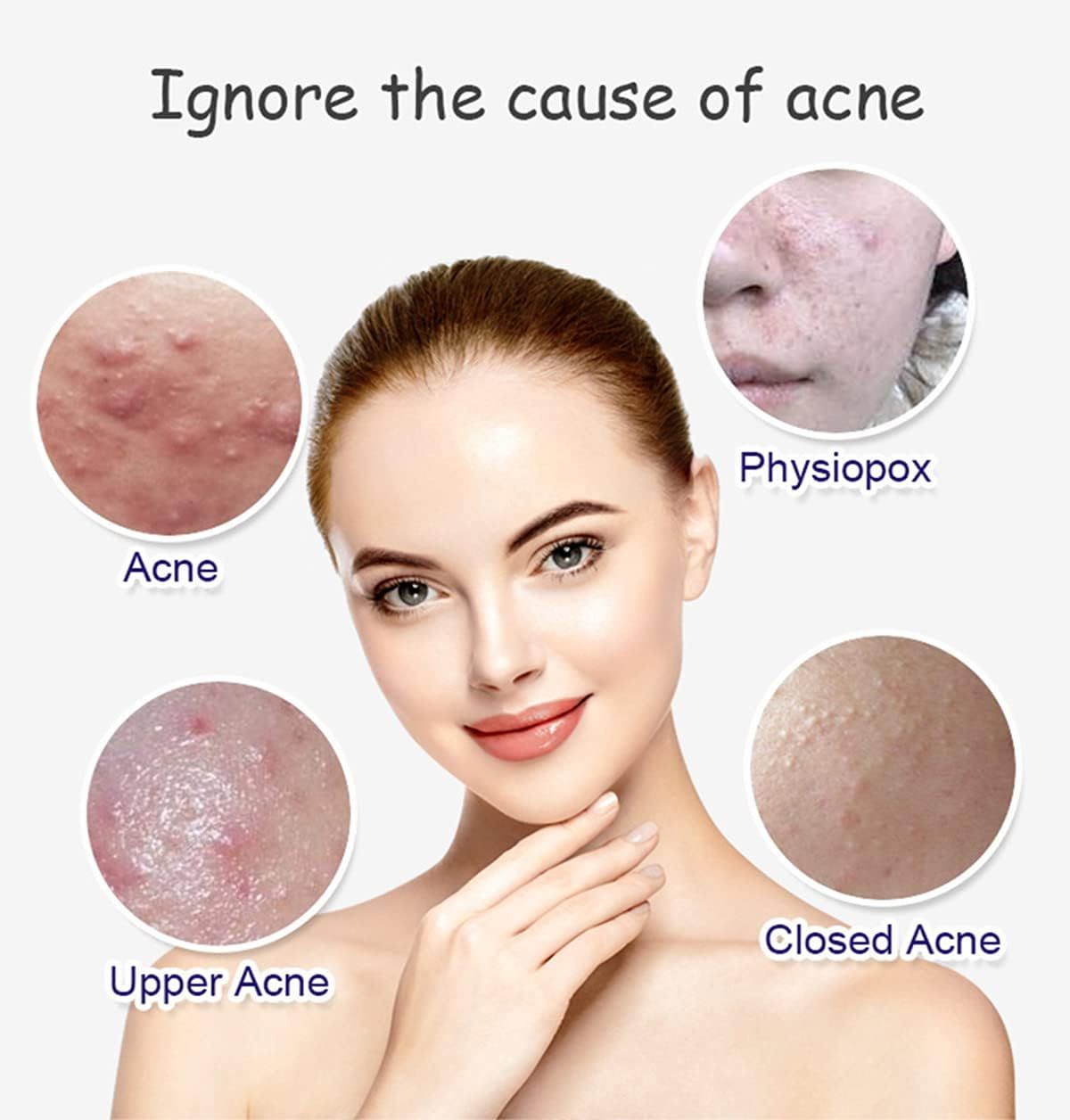 Aichun Beauty Anti - Acne Whitening Facial Serum Aloe Vera Extract Salicylic Acid Repairs Damaged Skin | 30ml View Gallery - Pakistan