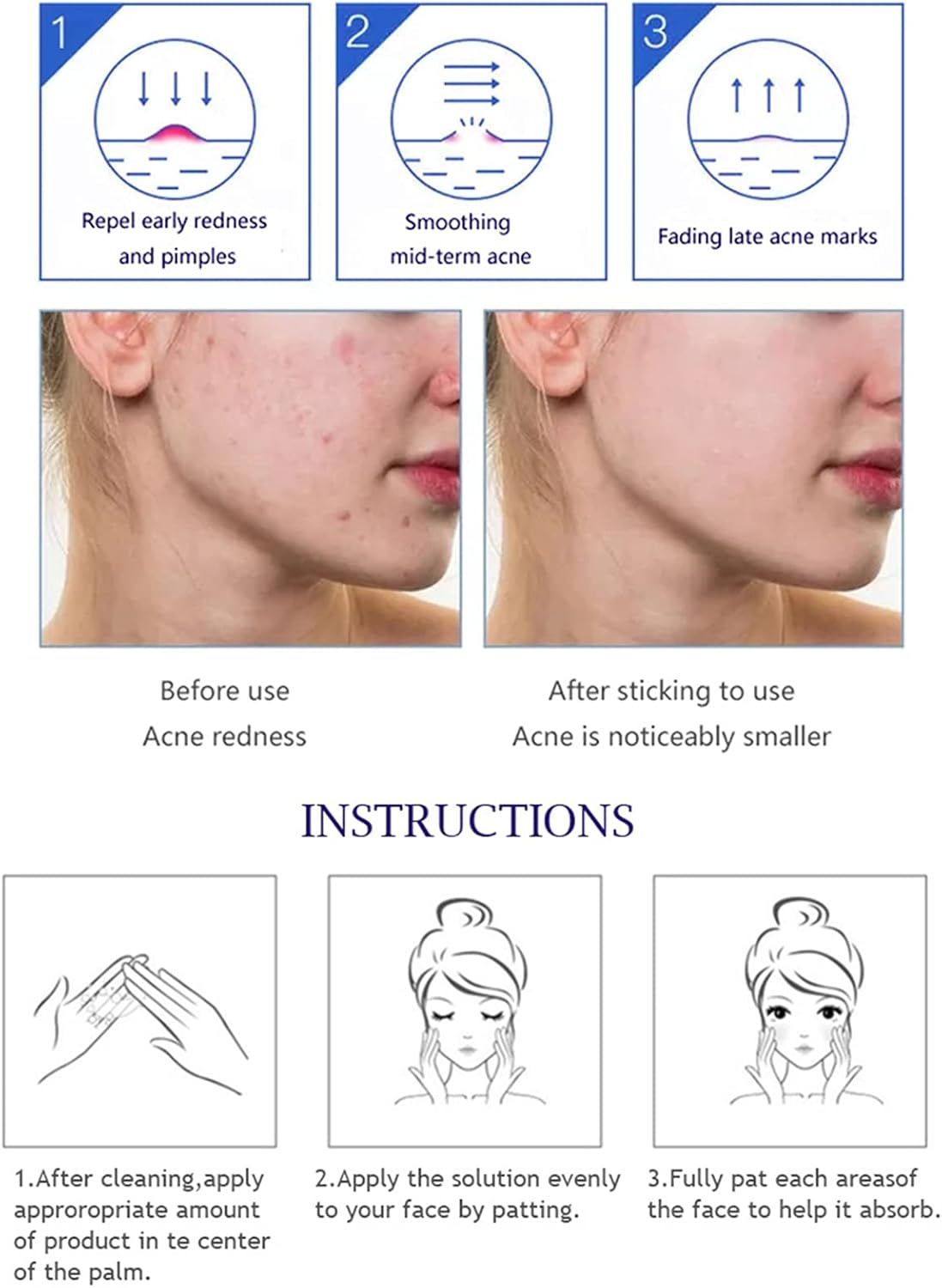 Aichun Beauty Anti - Acne Whitening Facial Serum Aloe Vera Extract Salicylic Acid Repairs Damaged Skin | 30ml View Gallery - Pakistan