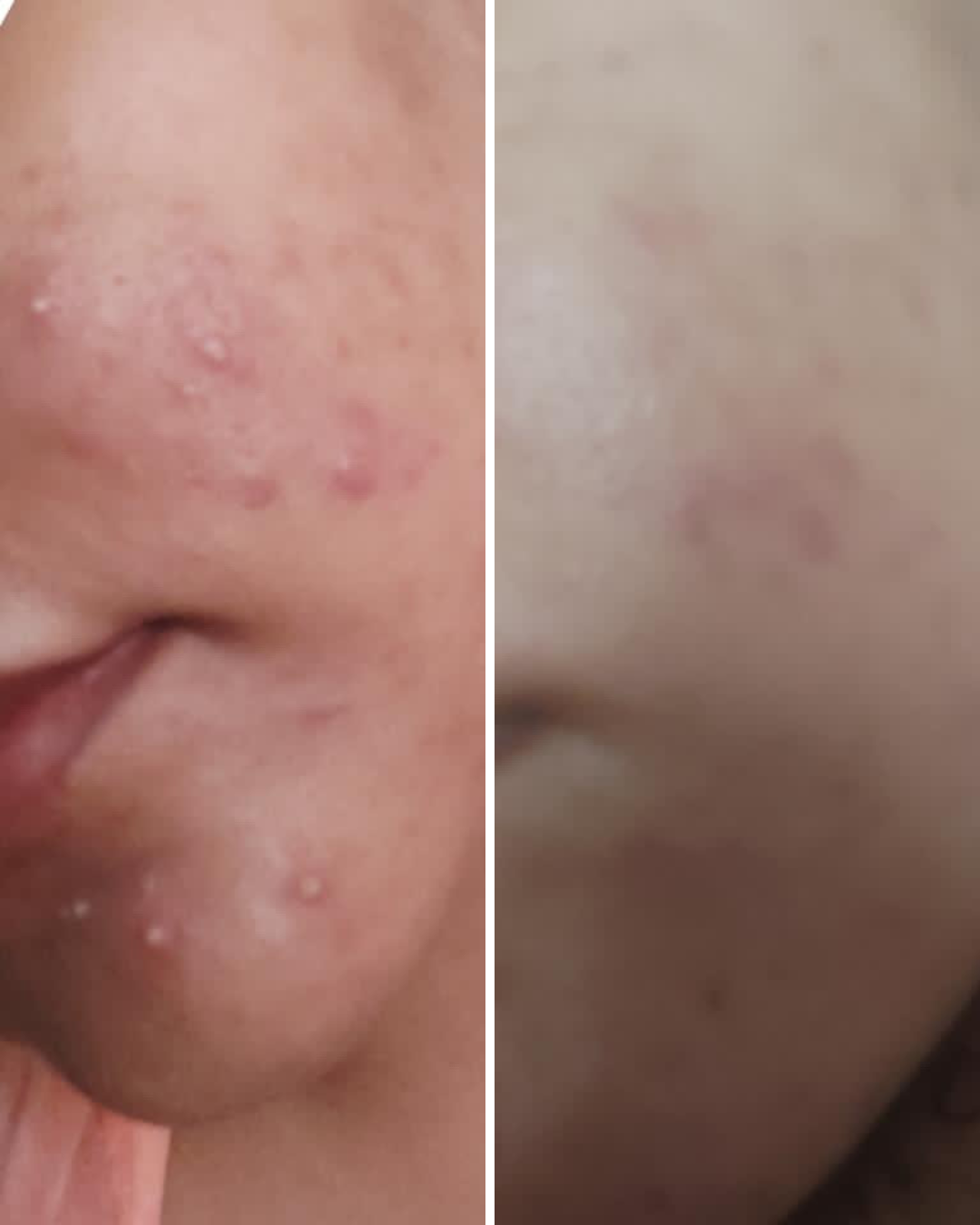 Nirvana Botanics Vitamin C + E Serum - 15ml | ANTI ACNE &amp; GLOWING SERUM VITAMIN C + E View Gallery - Pakistan