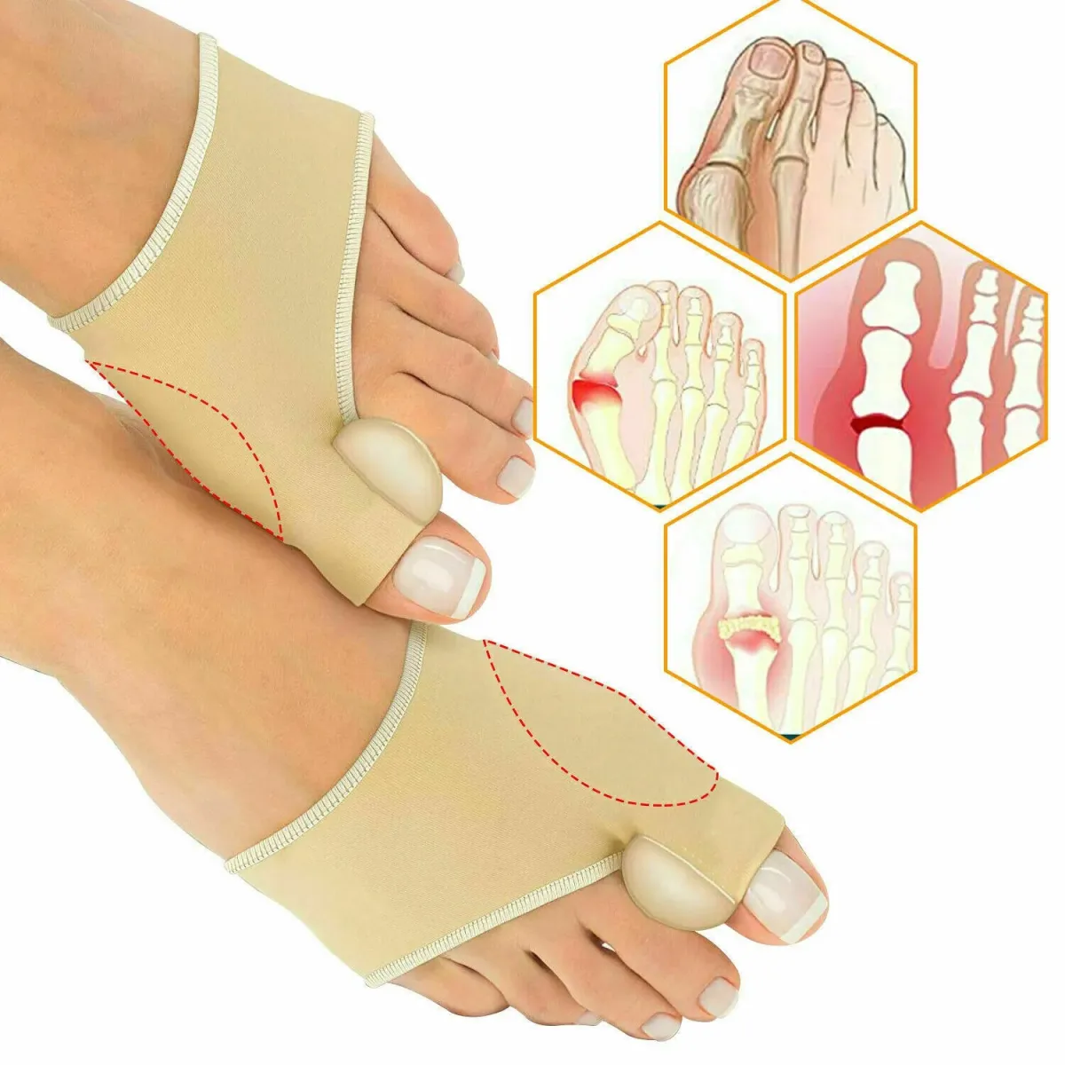 Smart Care Bunion Support Foot Mate Correction Socks Toes Separator Feet Care View Gallery - Pakistan