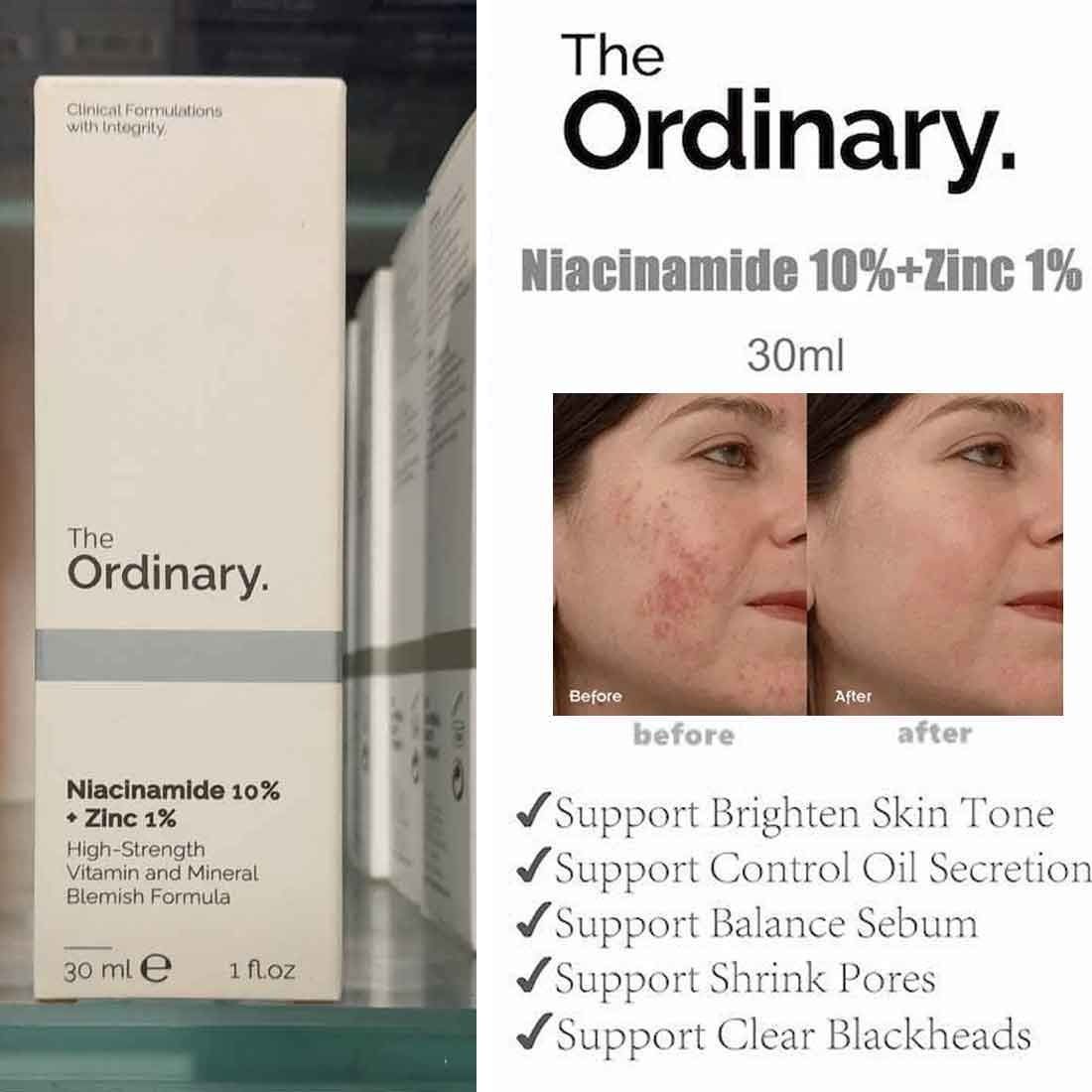 The Ordinary Skin Brightening Niacinamide 10% + Zinc 1% Serum 30ml View Gallery - Pakistan
