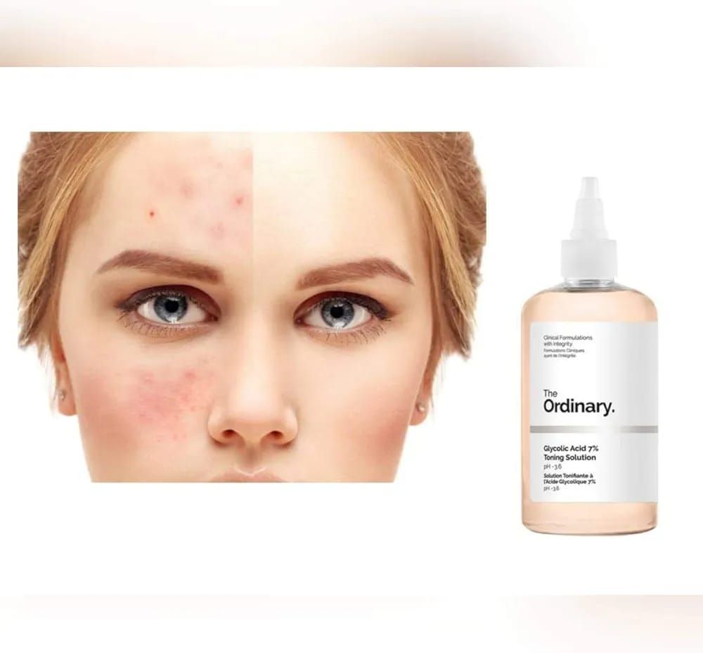 The Ordinary Glycolic Acid 7% Toning Solution Light Weight Liquid Provides Sun Protection 240ml View Gallery - Pakistan