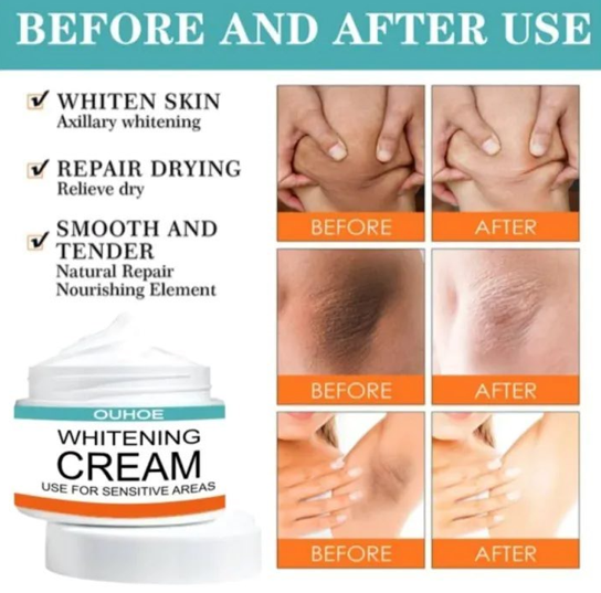 Pack Of 2 | Sensitive Area Whitening Cream for Private Parts, Underarms, Inner Thighs, and Dark Spot Lightening -30ml View Gallery - Pakistan