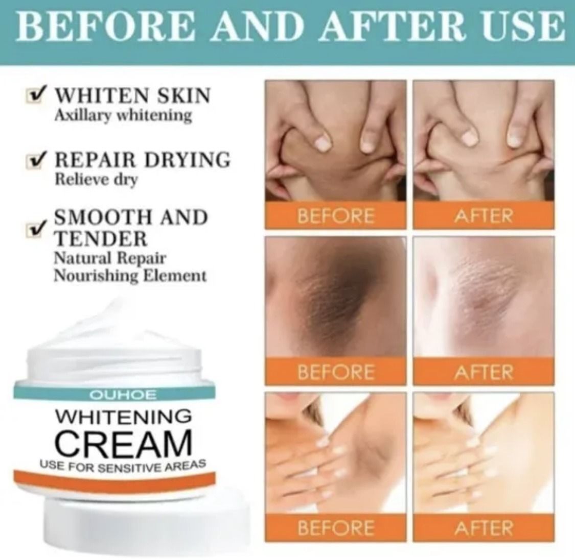 Sensitive Area Whitening Cream for Private Parts, Underarms, Inner Thighs, and Dark Spot Lightening(30ml) View Gallery - Pakistan