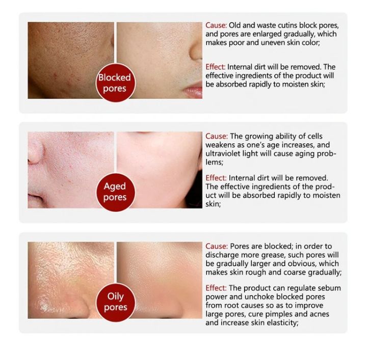 Rorec Moisturizing Anti Wrinkle Rice Face Serum for Open Pores 15ml View Gallery - Pakistan