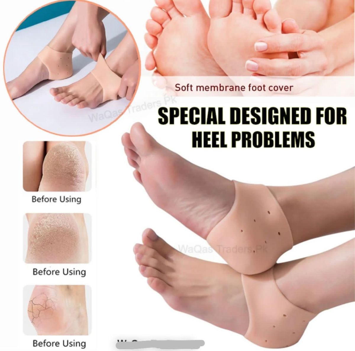 Pack of 2,Pair of half Heel Pain Anti Crack Silicone Set - Anti Crack  For Pain Relief Unisex View Gallery - Pakistan