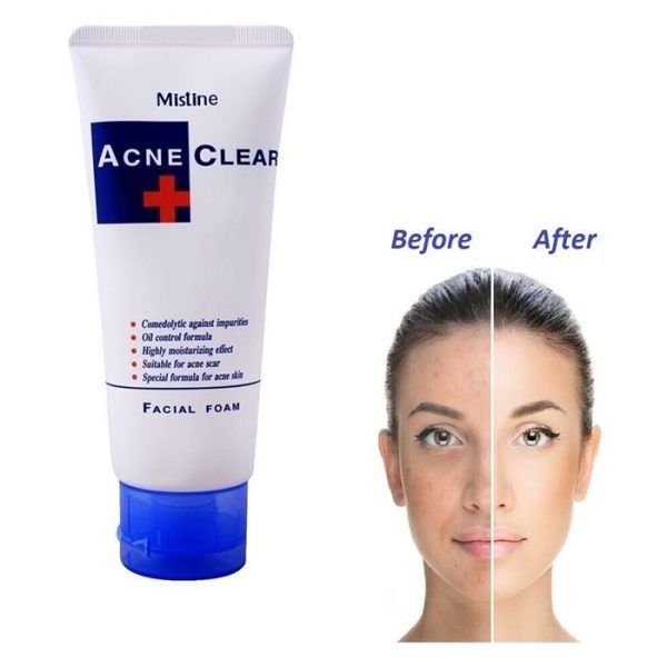 Mistine Acne Clear Face Wash Facial Foam 85 ml View Gallery - Pakistan