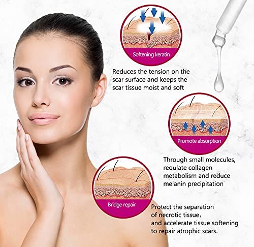 AICHUN BEAUTY Scar Removal Facial Serum Pimples Stretch Marks Face Moisturizing Body Remove Scars Kojic Acid Vitamin E 30ml View Gallery - Pakistan