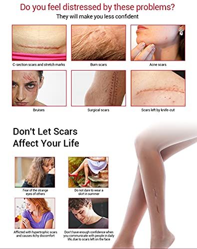AICHUN BEAUTY Scar Removal Facial Serum Pimples Stretch Marks Face Moisturizing Body Remove Scars Kojic Acid Vitamin E 30ml View Gallery - Pakistan