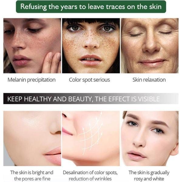 100% original Aichun Anti Freckle Whitening Facial Serum 30ml View Gallery - Pakistan