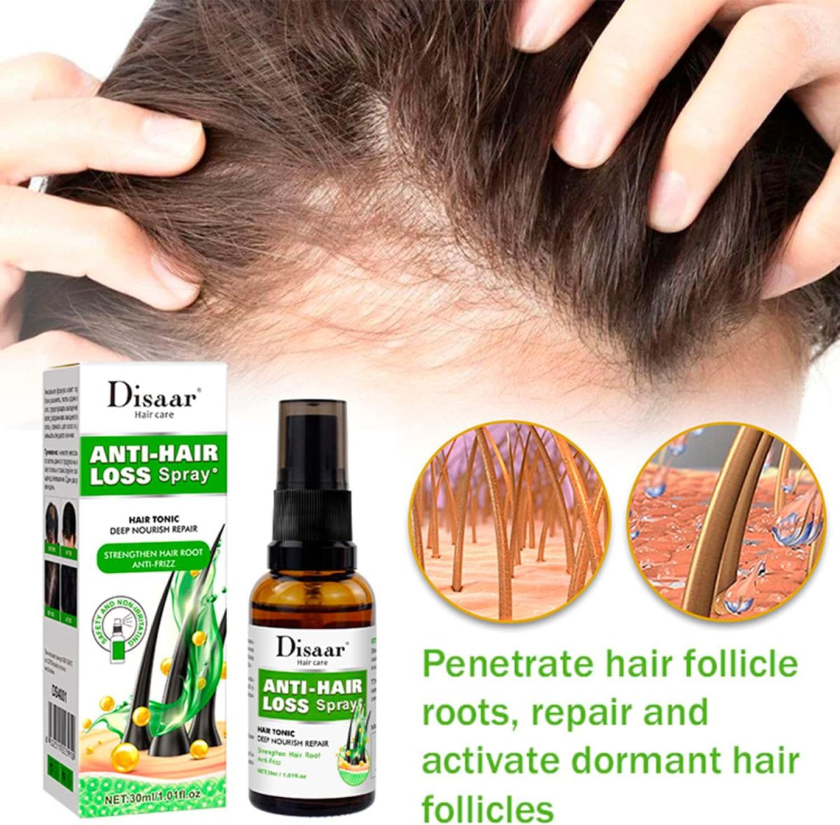 Anti-Hair Loss Spray Tonic Deep Moisturize Nourish Repair Strengthen Hair Root Anti-Frizz Care 30ml View Gallery - Pakistan