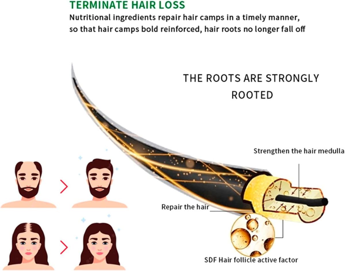 Anti-Hair Loss Spray Tonic Deep Moisturize Nourish Repair Strengthen Hair Root Anti-Frizz Care 30ml View Gallery - Pakistan