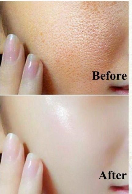 Korean glass skin pearl white serum (30 ml) View Gallery - Pakistan