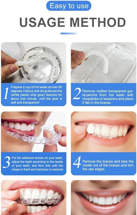 Snap On Smile - Veneers Teeth for Men and Women - Moldable False Artificial Braces Teeth View Gallery - Pakistan