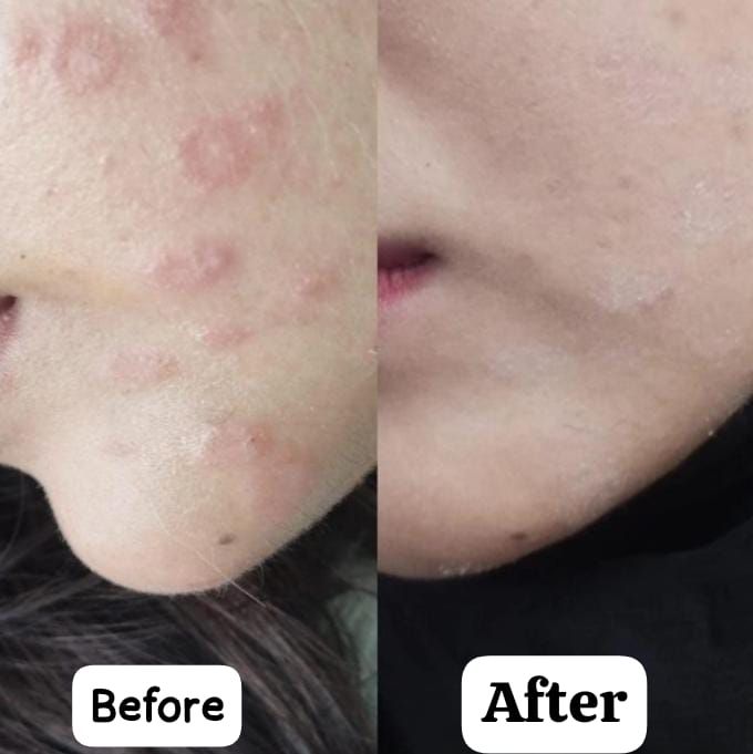 KC Hydraluxe Skin care Serum  | Natural Purity &amp; Radiance 30 ml / 1.01 fl. oz. View Gallery - Pakistan